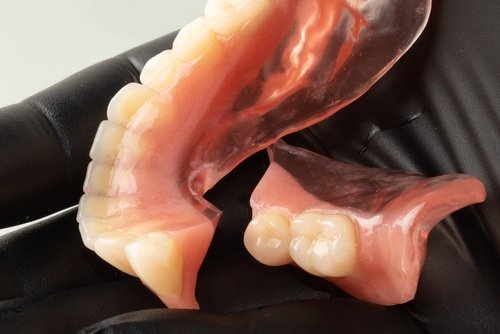 broken lower denture